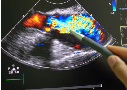 Fellowship in Echocardiography - Cardiology Course